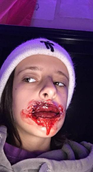 Kenna Ingles blood